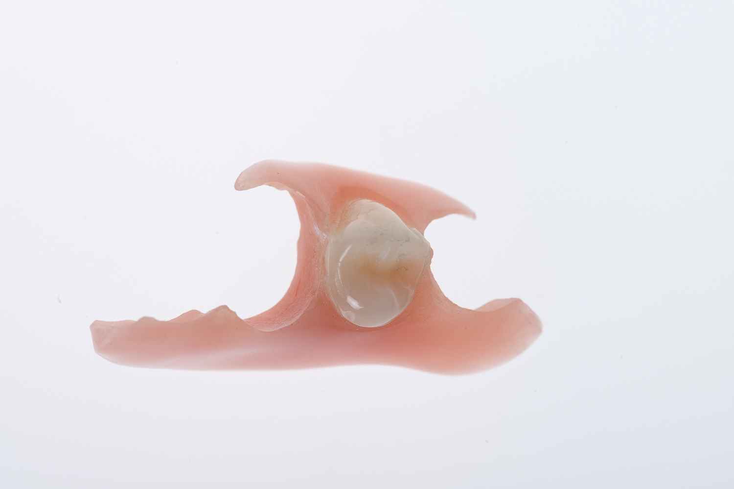 Single Tooth Partial Removable Denture Costs Gold Coast